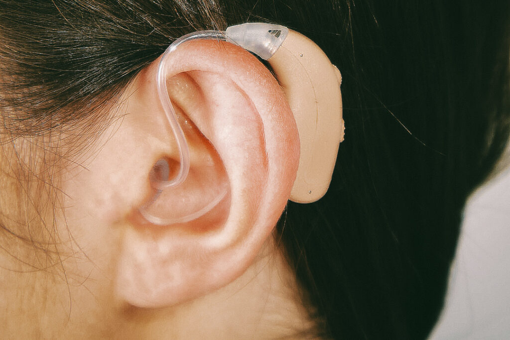 A white woman with brown hair wears an  MDHearing hearing aid