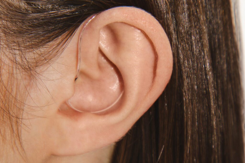 A white woman with brown hair wears a Starkey hearing aid